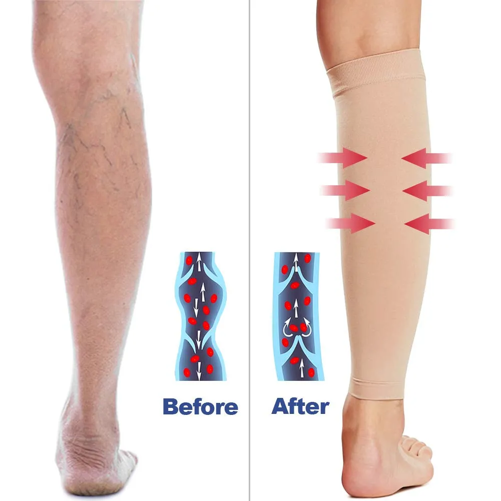 Beister 1 Pair Compression Calf Sleeves (20-30mmHg), Perfect Calf Compression Socks for Running, Shin Splint, Medical, Calf Pain Relief, Air Travel, Nursing, Cycling X-Large Beige